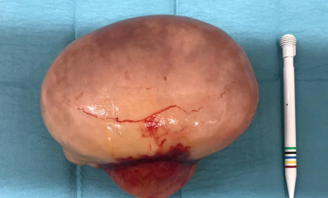 Dierenartsen uit Hellendoorn halen mysterieuze bult uit paard