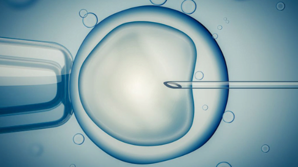 OPU en ICSI, wat is dat eigenlijk?